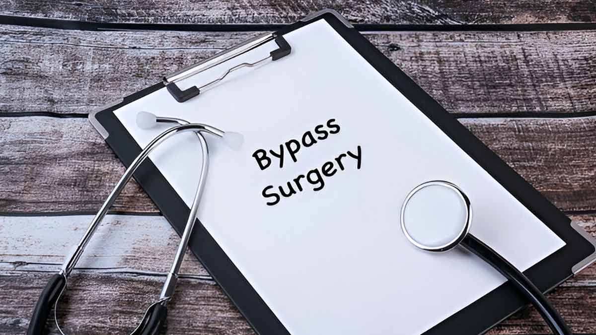 Total Arterial Bypass Surgery: Is It The New Gold Standard In Heart Care?