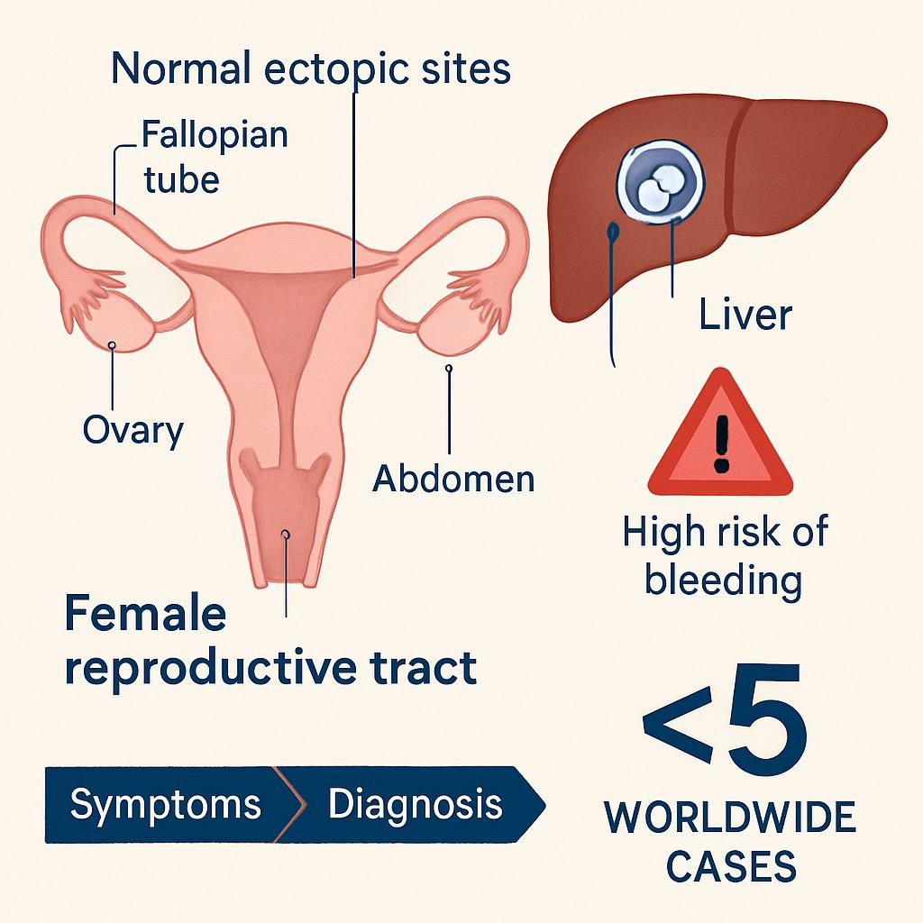 signs of ectopic pregnancy