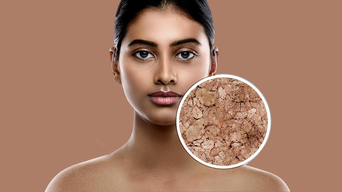 DIY Beauty Gone Wrong: Common Mistakes to Avoid with Home Remedies