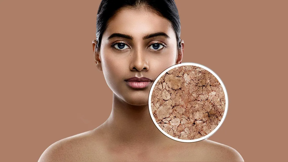 DIY Beauty Gone Wrong: Common Mistakes to Avoid with Home Remedies