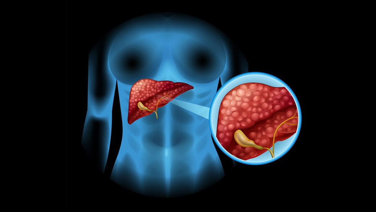 1-liver
