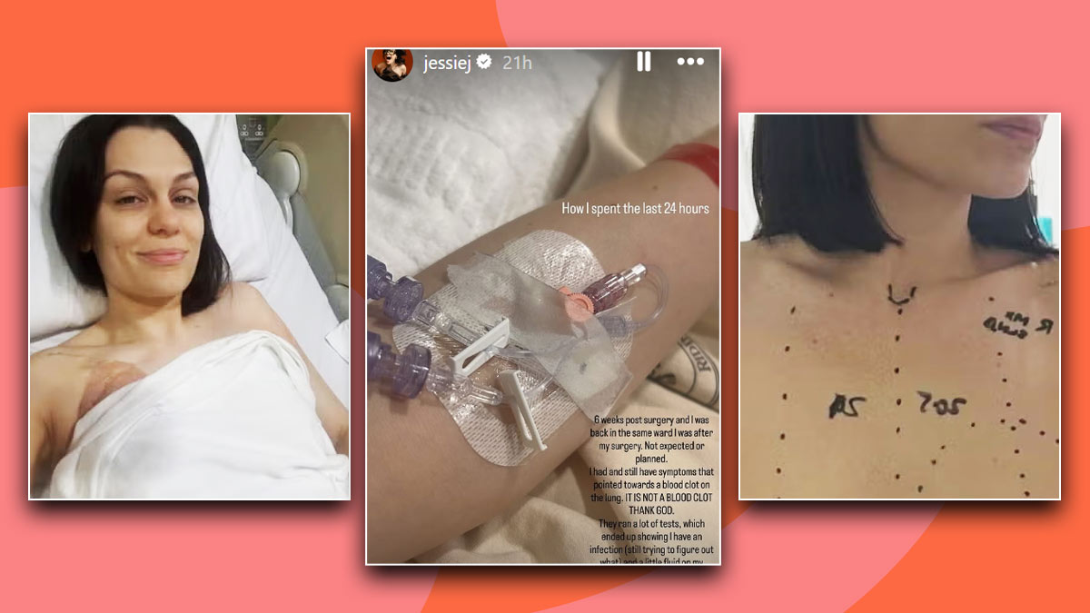 Jessie J Hospitalised for Infection Six Weeks After Breast Cancer Surgery - Report