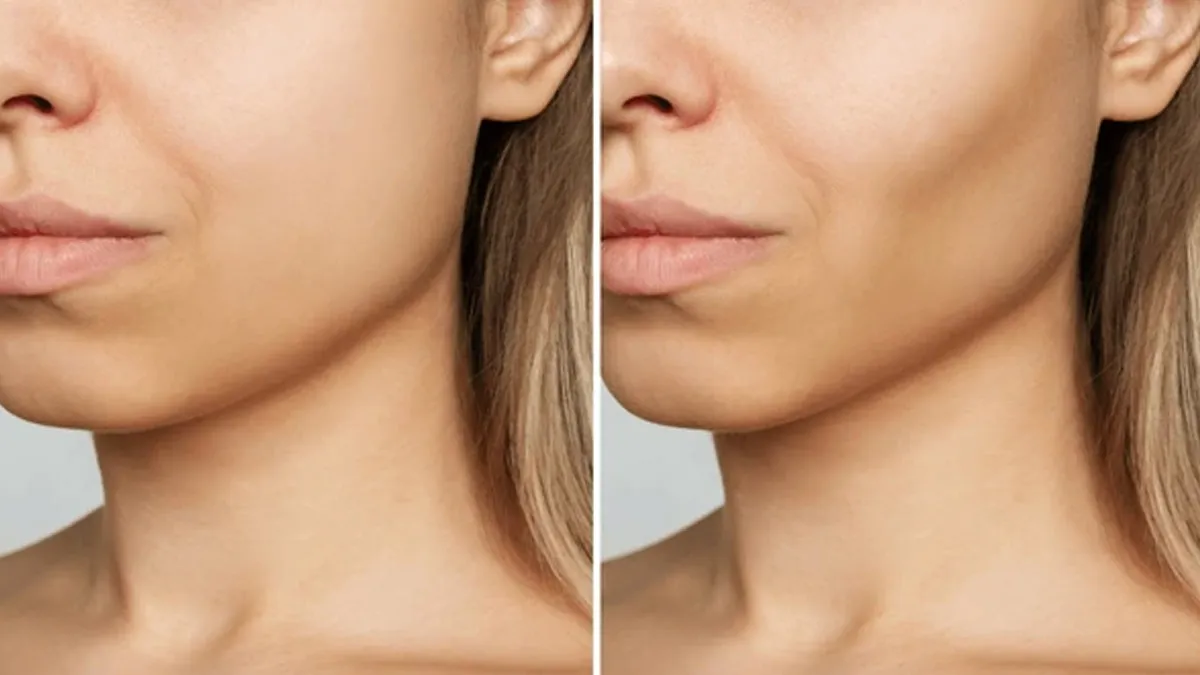 Is Ozempic Face A Growing Cause Of Concern? Know What Is It