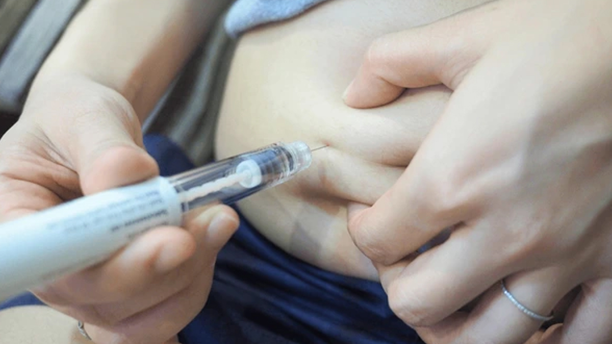 stimulation-injection