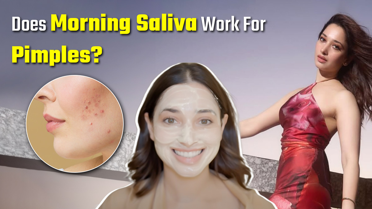 Morning Saliva for Clear Skin? Tamannah Bhatia Shares Jaw-Dropping Acne Hack Using Spit