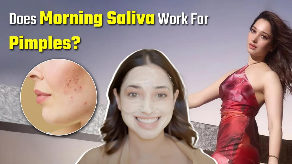 Morning Saliva for Clear Skin? Tamannah Bhatia Shares Jaw-Dropping Acne Hack Using Spit