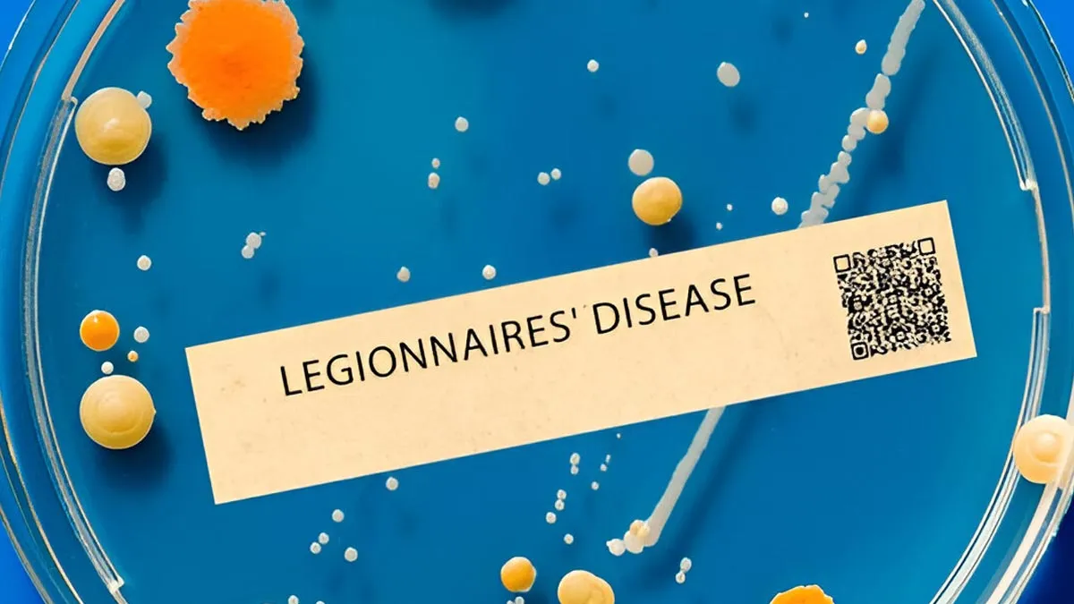 What Is Legionnaires’ Disease That Has Claimed 2 Lives And Infected 58 In New York? Know Symptoms, Causes, And Prevention tips