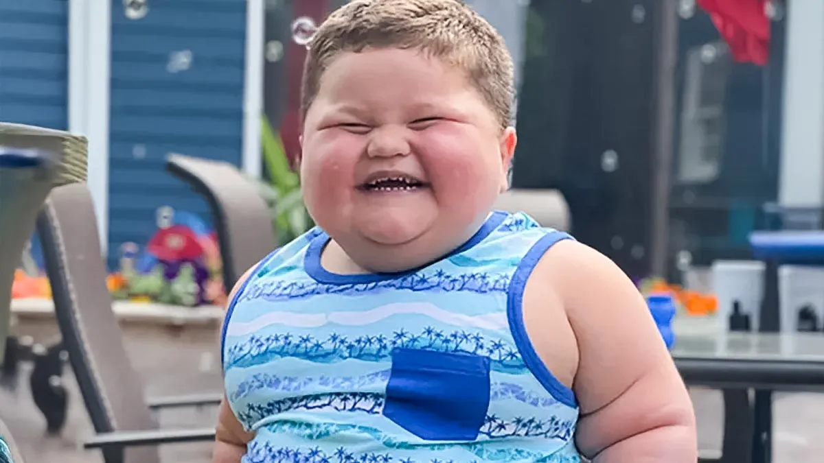 How This Toddler Weighed 100 Pounds and Was Always Hungry Even After Meals: Exploring The Leptin Deficiency