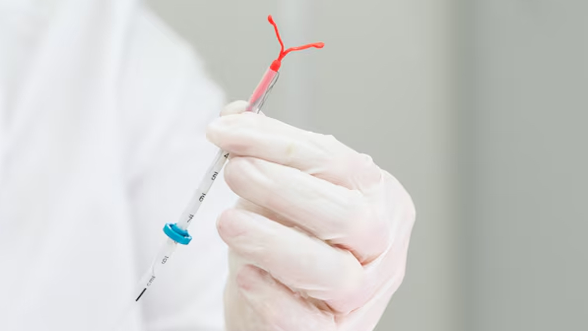Is IUD Removal Painful? What To Expect, As Per A Doctor