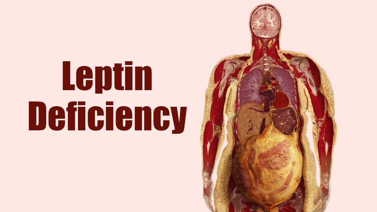 Leptin Deficiency 3 - 2025-08-08T121651.177
