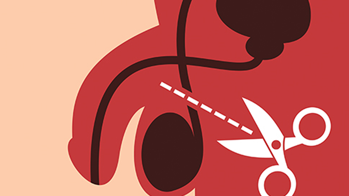 Vasectomy 4 - 2025-08-08T102317.800