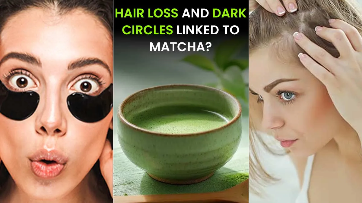 Is Your Matcha Causing Hair Loss and Dark Circles? What You Need to Know