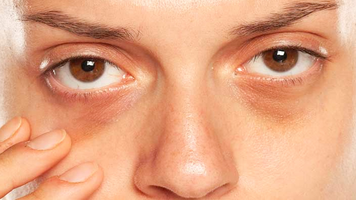 matcha causes dark circles 1 - 2025-08-12T102655.896