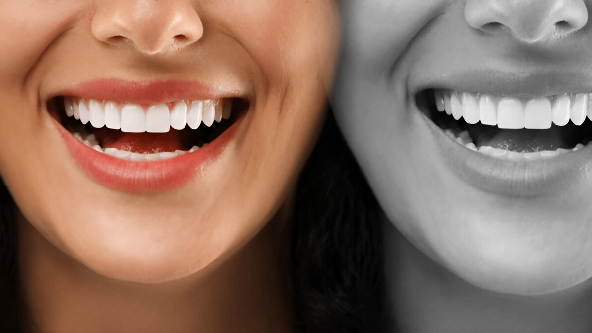 Say Goodbye To Stains: Natural Ways To Whiten Teeth Without Damaging Enamel