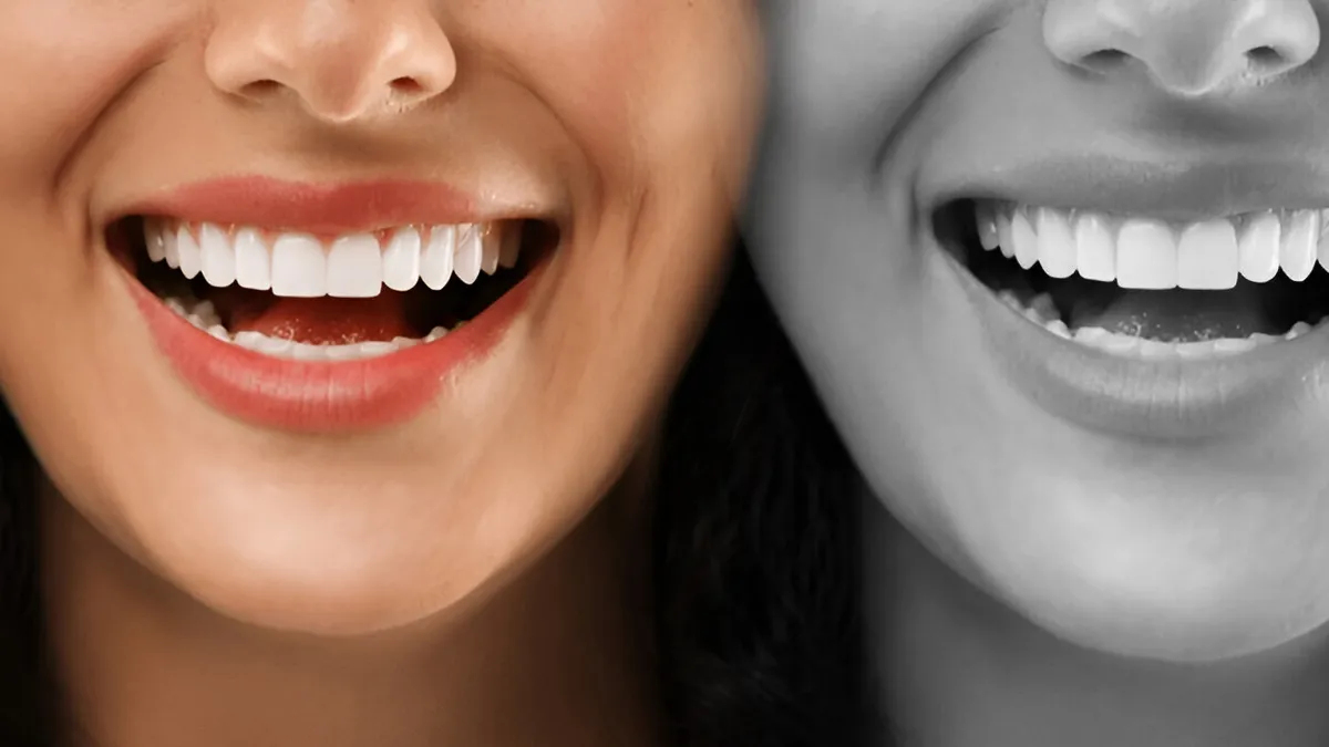Say Goodbye To Stains: Natural Ways To Whiten Teeth Without Damaging Enamel