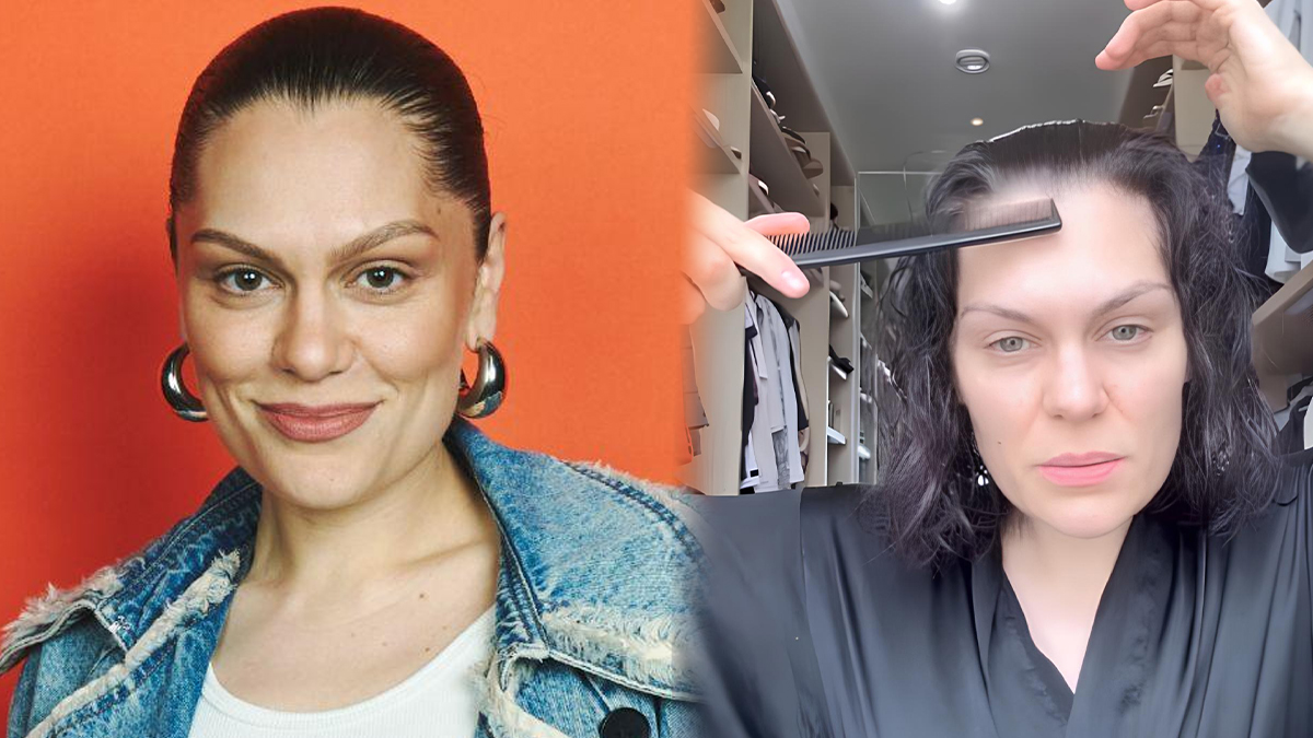 After Breast Cancer Surgery, Jessie J Says Her Hair Is Falling Out ‘Like Crazy’: Is It Normal?