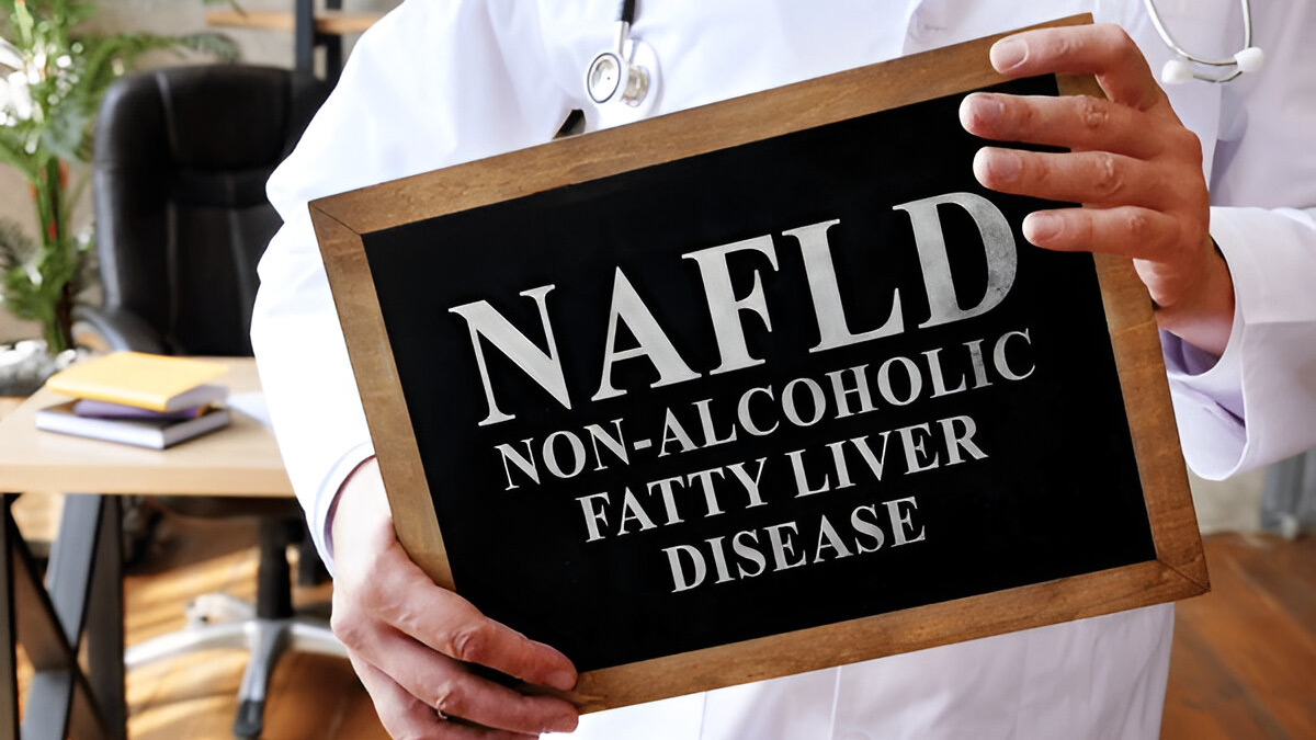 NAFLD