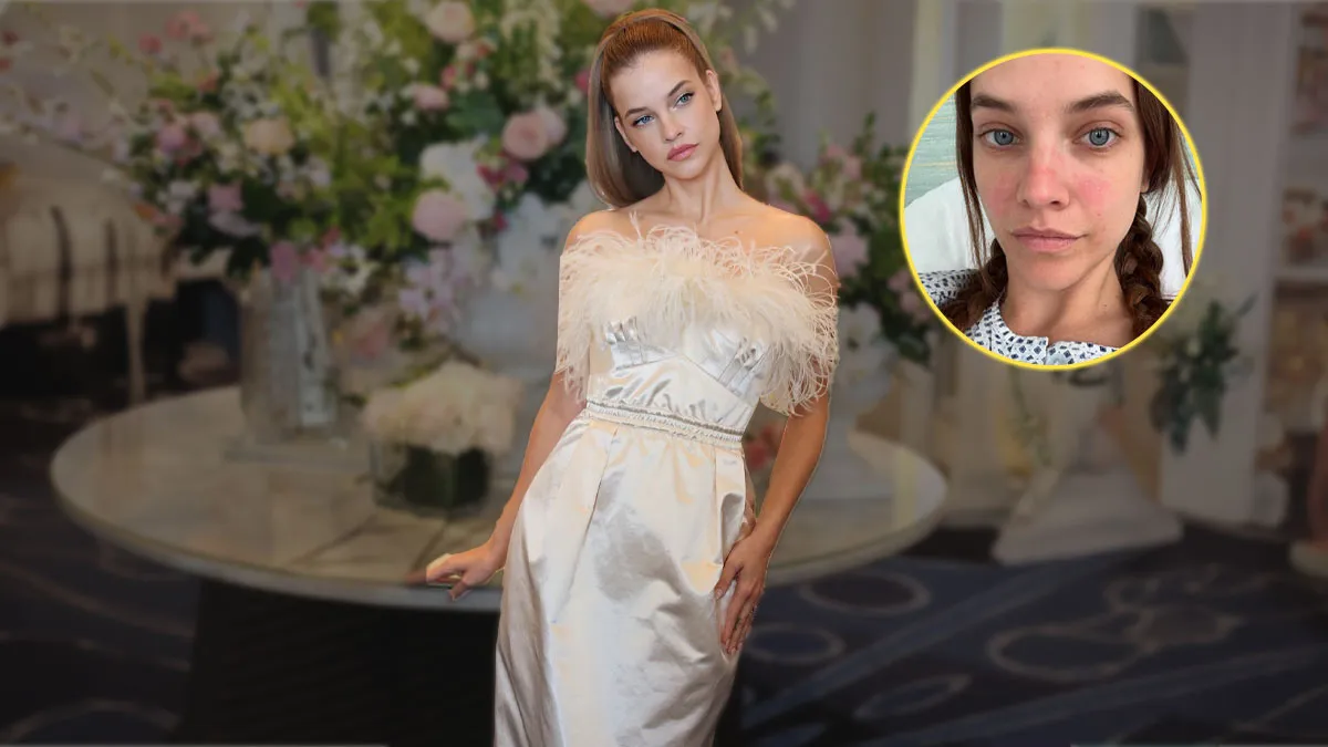 Barbara Palvin Reveals Secret Health Battle: 'I Thought the Pain Was Normal', Until Surgery Changed Everything
