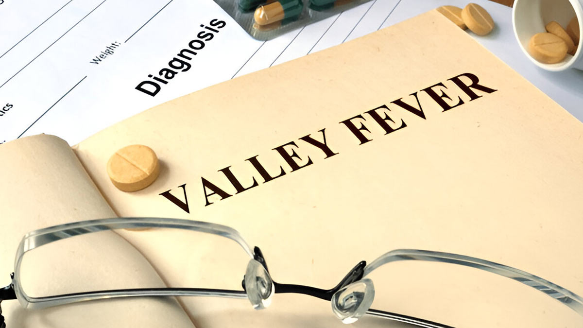 Valley Fever Outbreak: California Sees Alarming Surge In Cases, Know the Symptoms and Stay Safe
