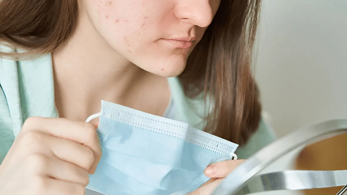 Maskne Is Back: How To Care For Skin In Humid Weather
