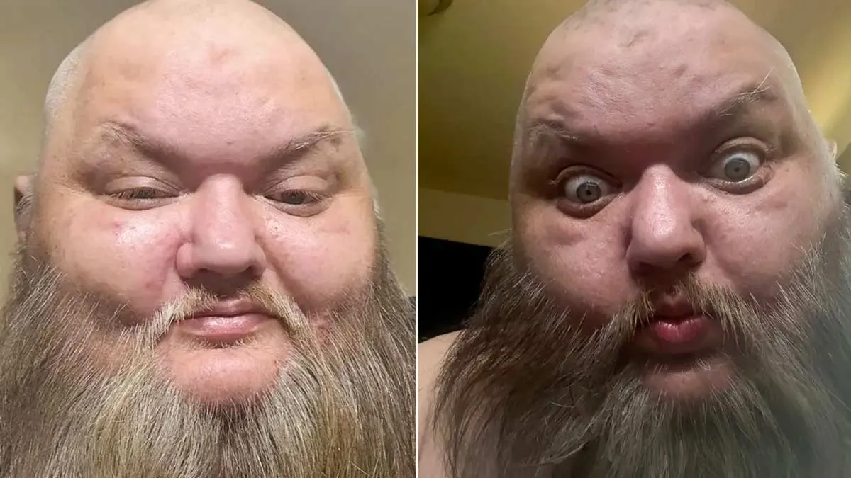 John Crawley, Famous as KingBeardX for His Food Reaction TikTok Videos, Dies of Cardiac Arrest at 47 - Report