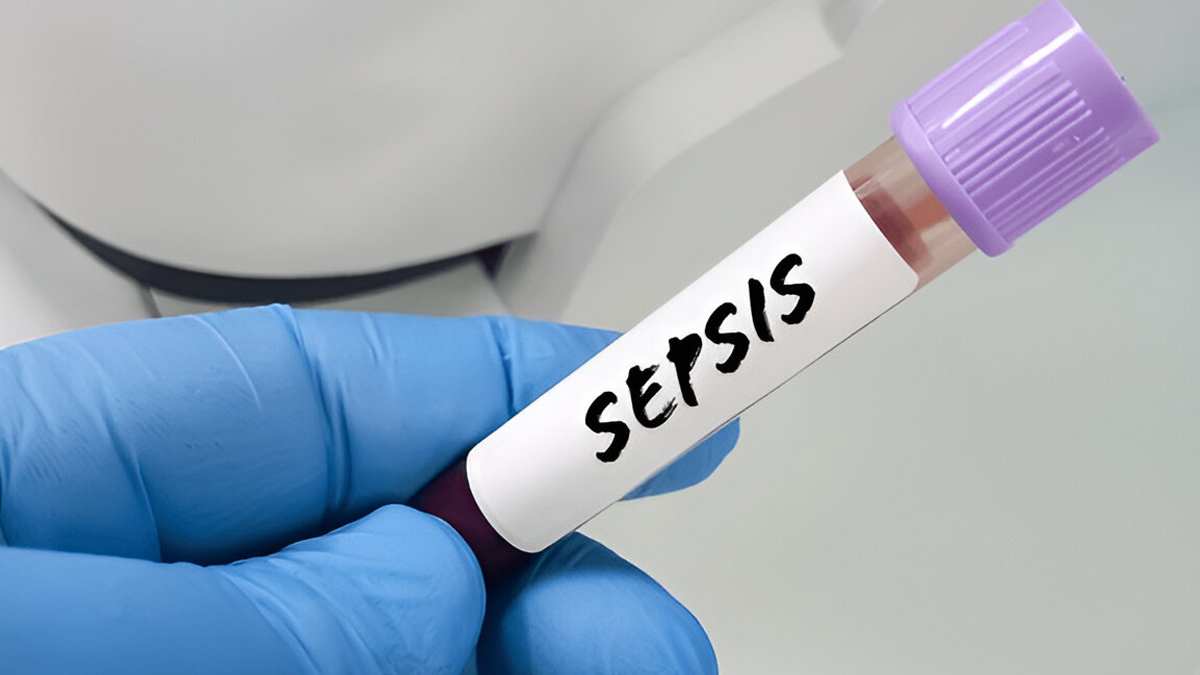 sepsis