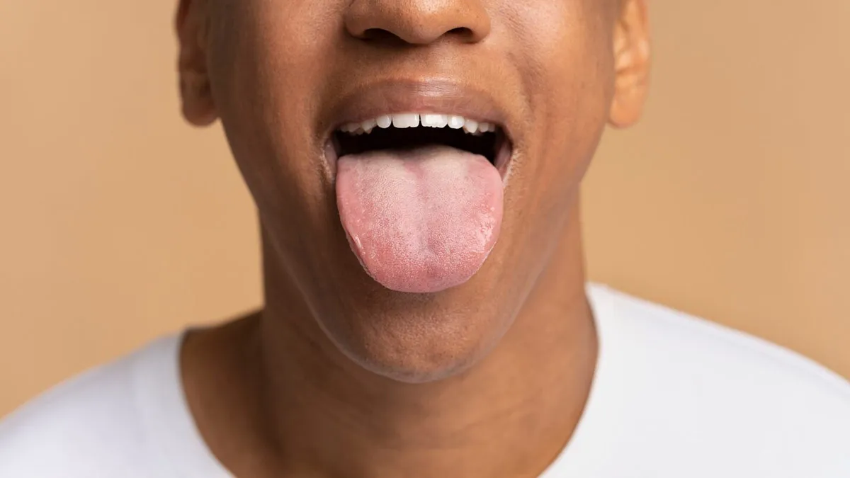 Why Tongue Cancer Risk Isn’t Just About Tobacco
