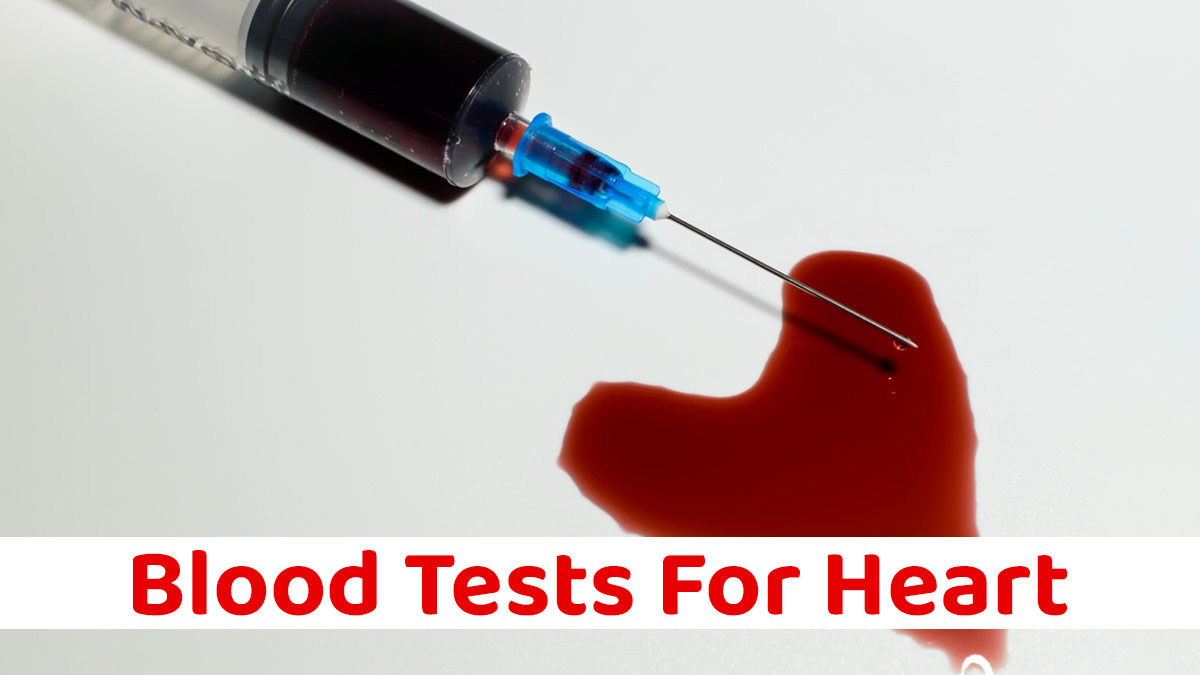 10 Blood Tests Your Heart Wishes You Knew to Avoid Bypass Surgery