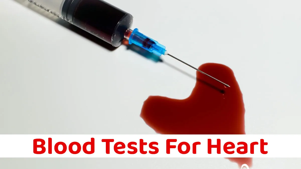 10 Blood Tests Your Heart Wishes You Knew to Avoid Bypass Surgery