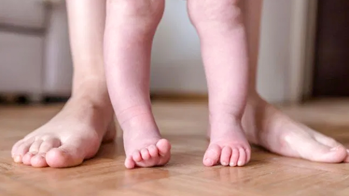 bow legs 2 - 2025-08-26T120950.299