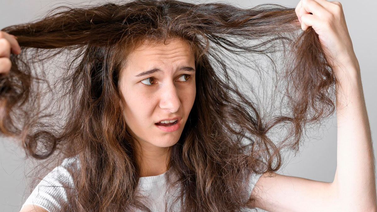 dry-frizzy-hair
