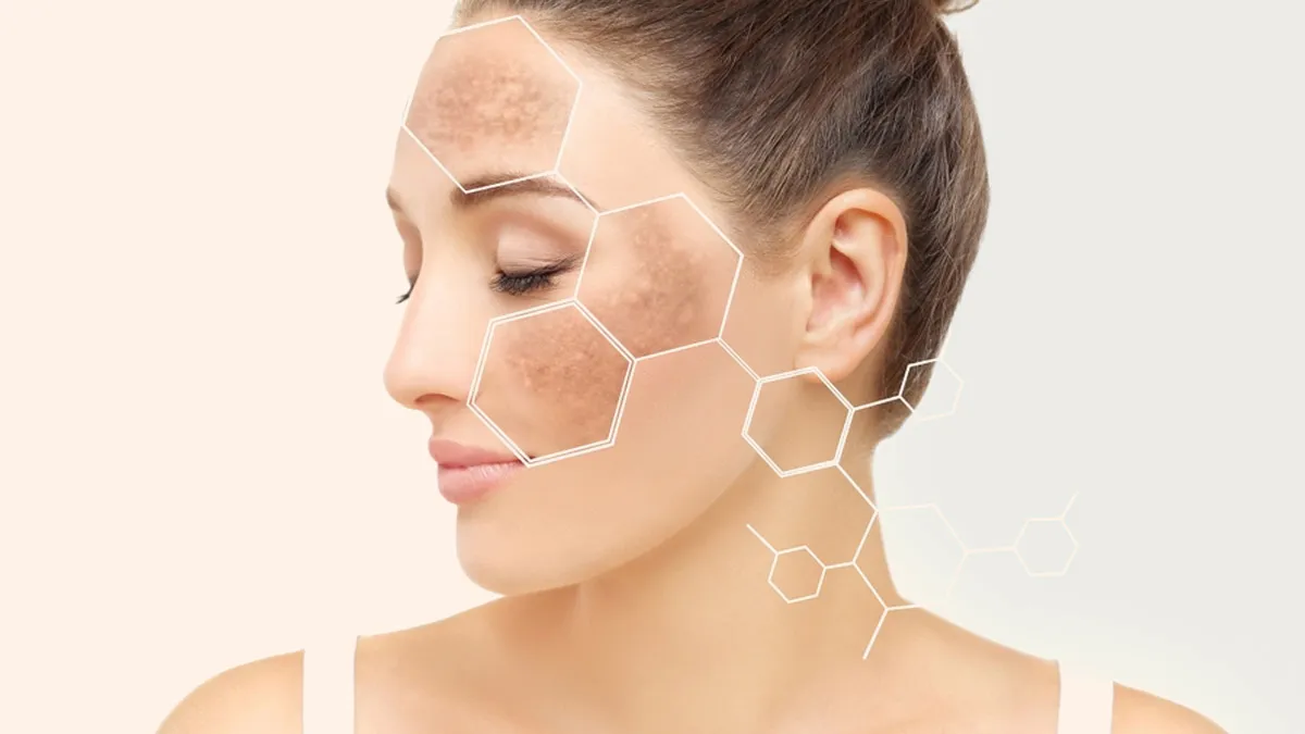 Does Melatonin Affect Skin Pigmentation? Find Out Here