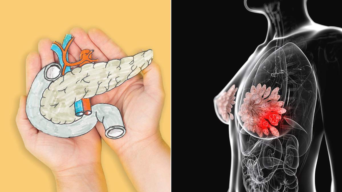 Diabetes Makes Breast Cancer More Aggressive? New Study Claims