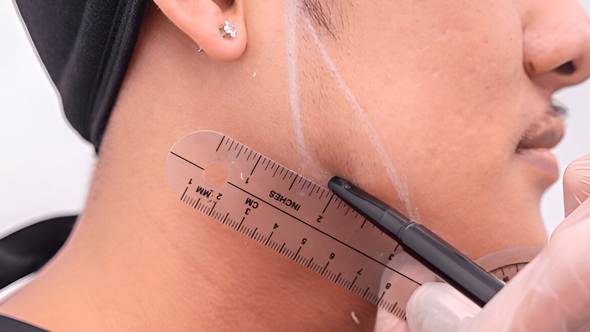 removing-fat-from-jawline