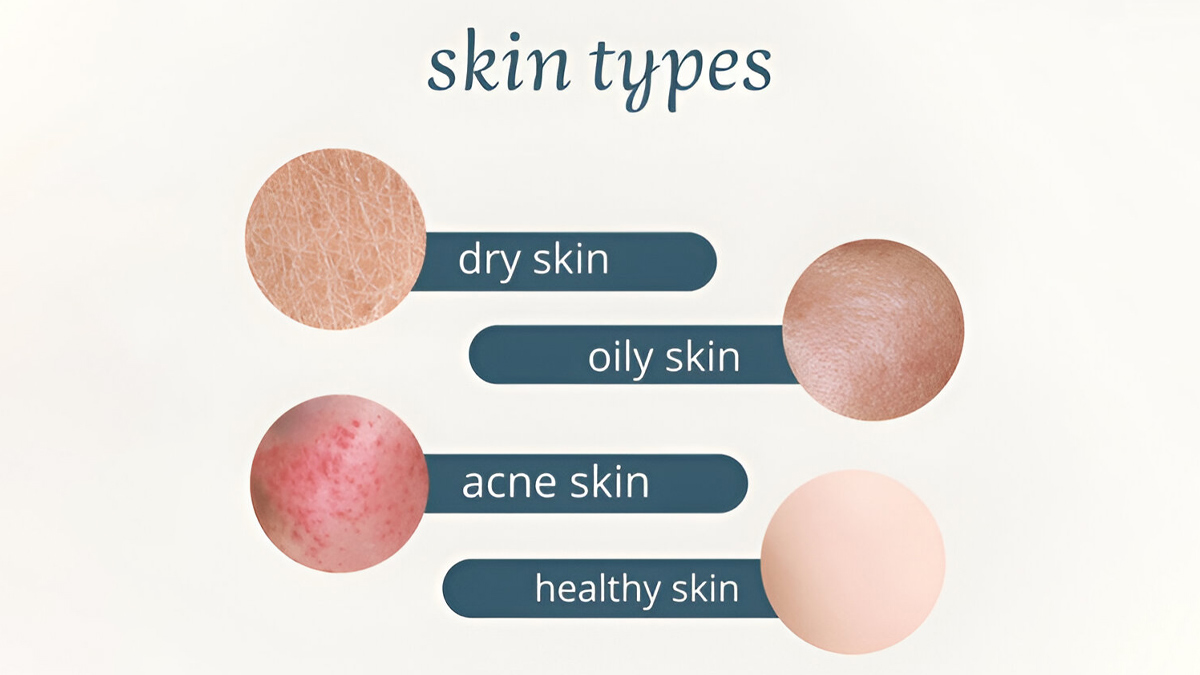 skin-type