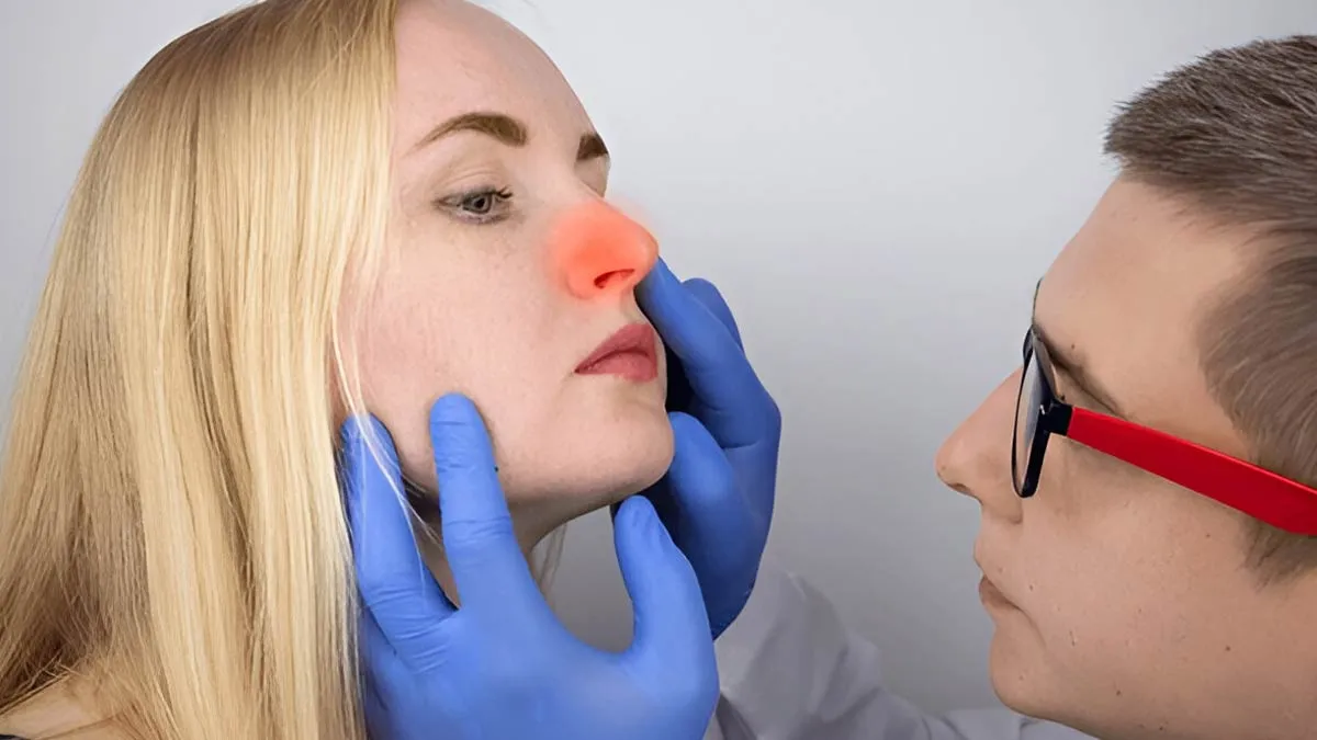 Trouble Breathing Through Your Nose? 10 Things To Know About Nasal Polyps