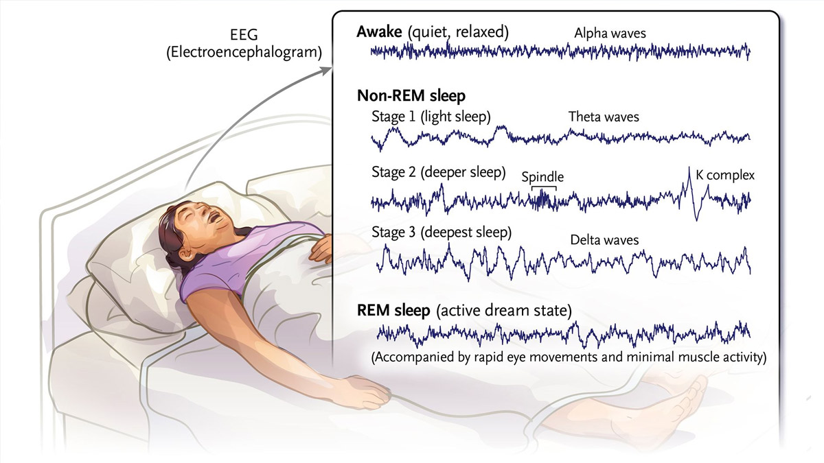 rem sleep 2 - 2025-08-29T132027.887