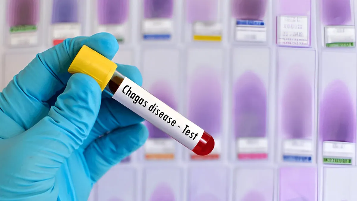 What Is Chagas Disease? Signs Of The ‘Kissing Bug’ Infection Now Emerging in the US