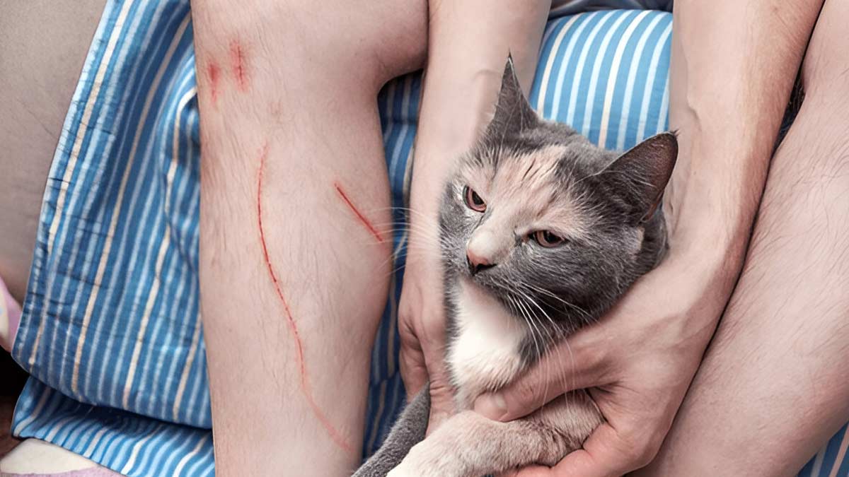 Not Just Rabies, A Cat's Scratch Can Give You Another Disease: Here's All You Need To Know