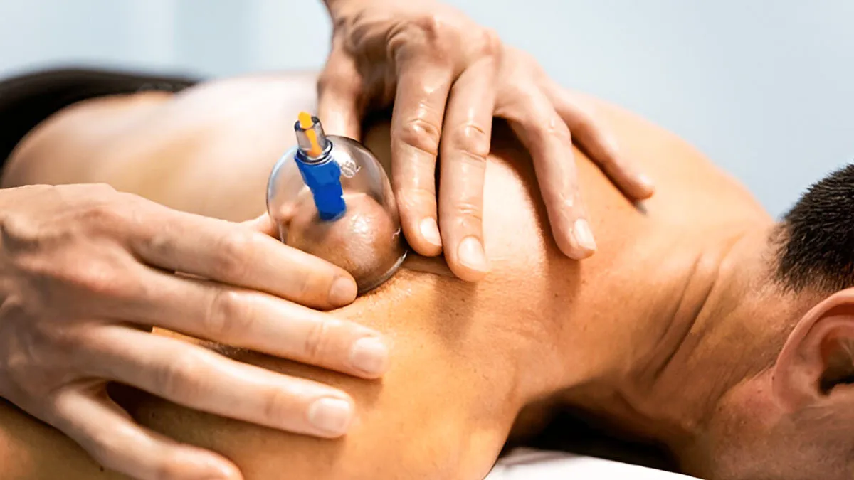 Cupping Therapy:  What Is It, How It Works, Its Potential Benefits, And What To Keep In Mind