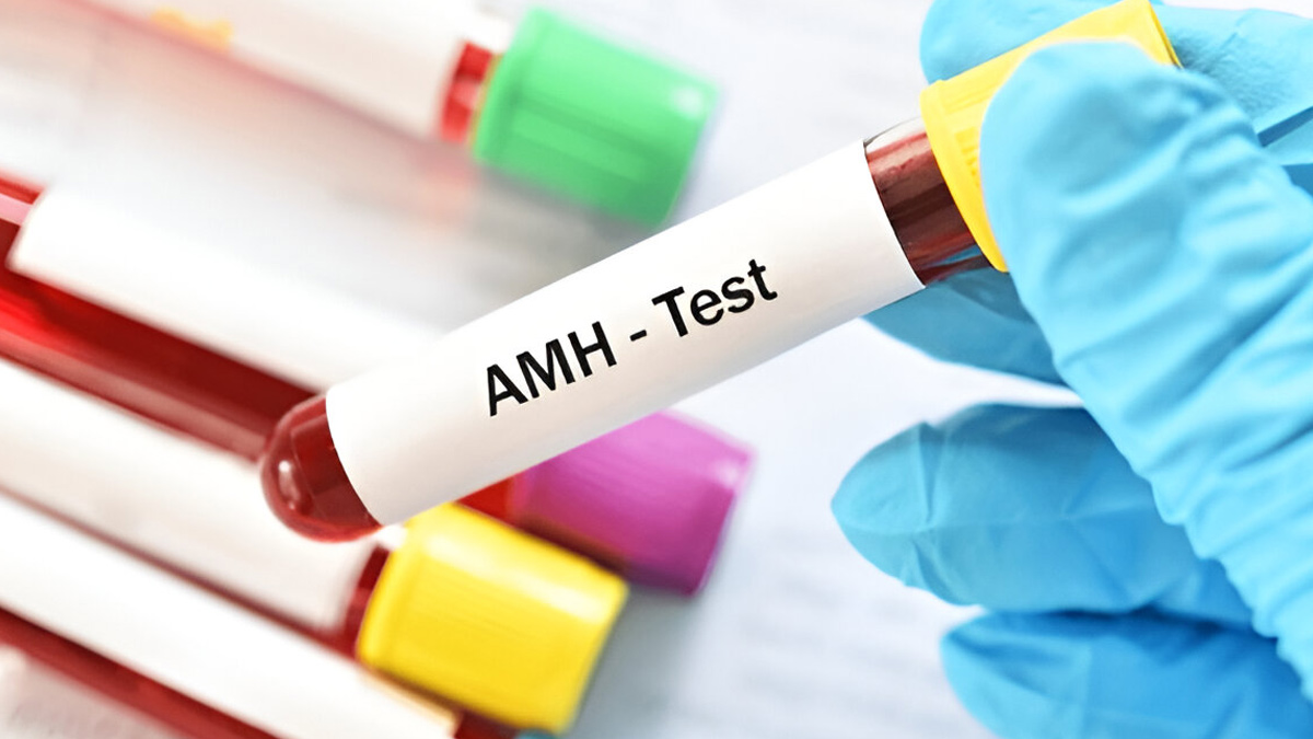 Anti-Müllerian-Hormone-test