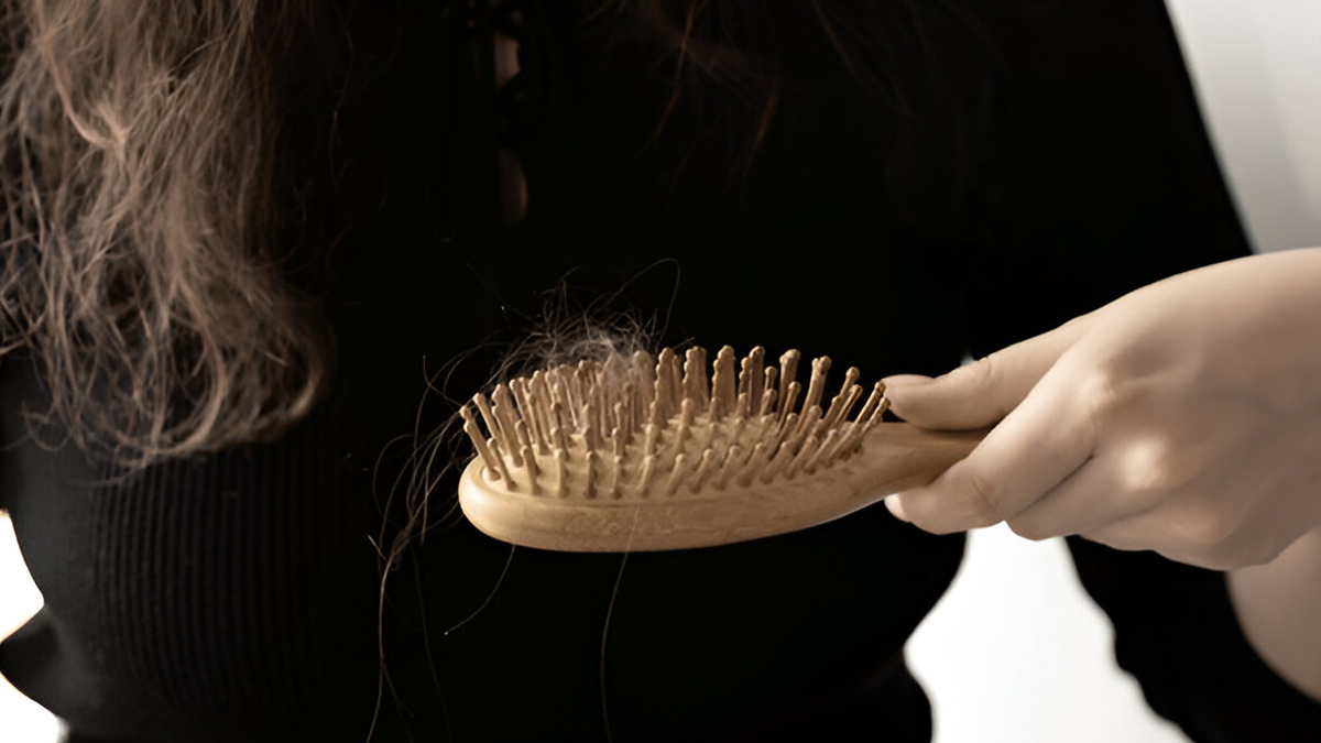 hair-fall