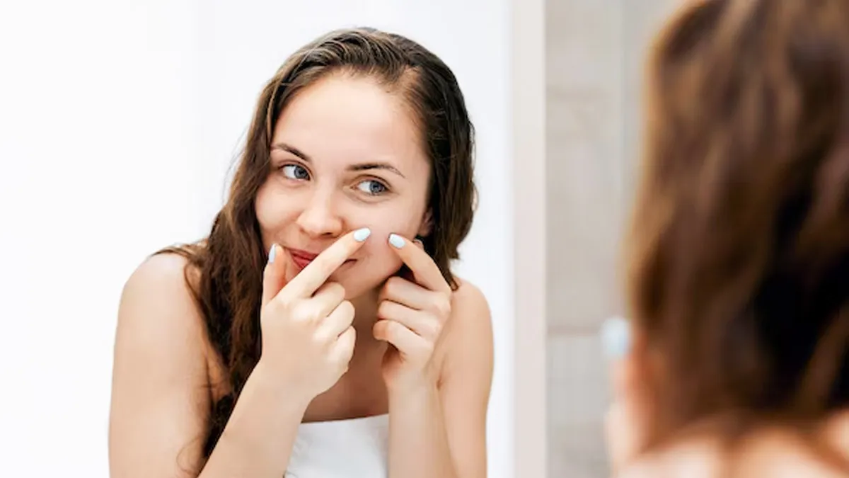 Morning Saliva for Pimples: Myth or Medical Fact?
