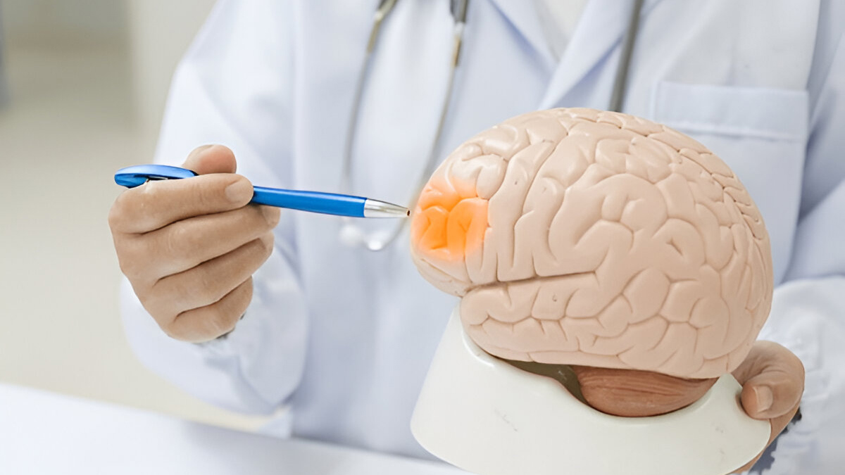 Hydrocephalus-water-on-brain