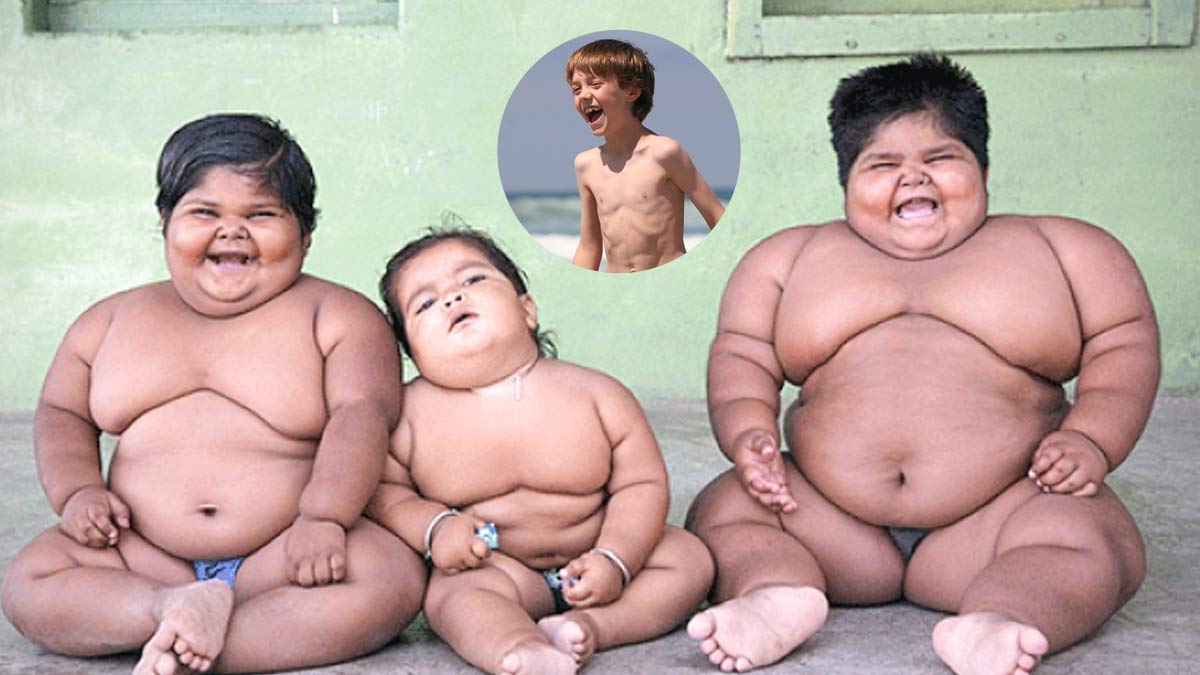 188 Million Children Worldwide Now Obese, Surpassing Underweight Cases, UNICEF Finds