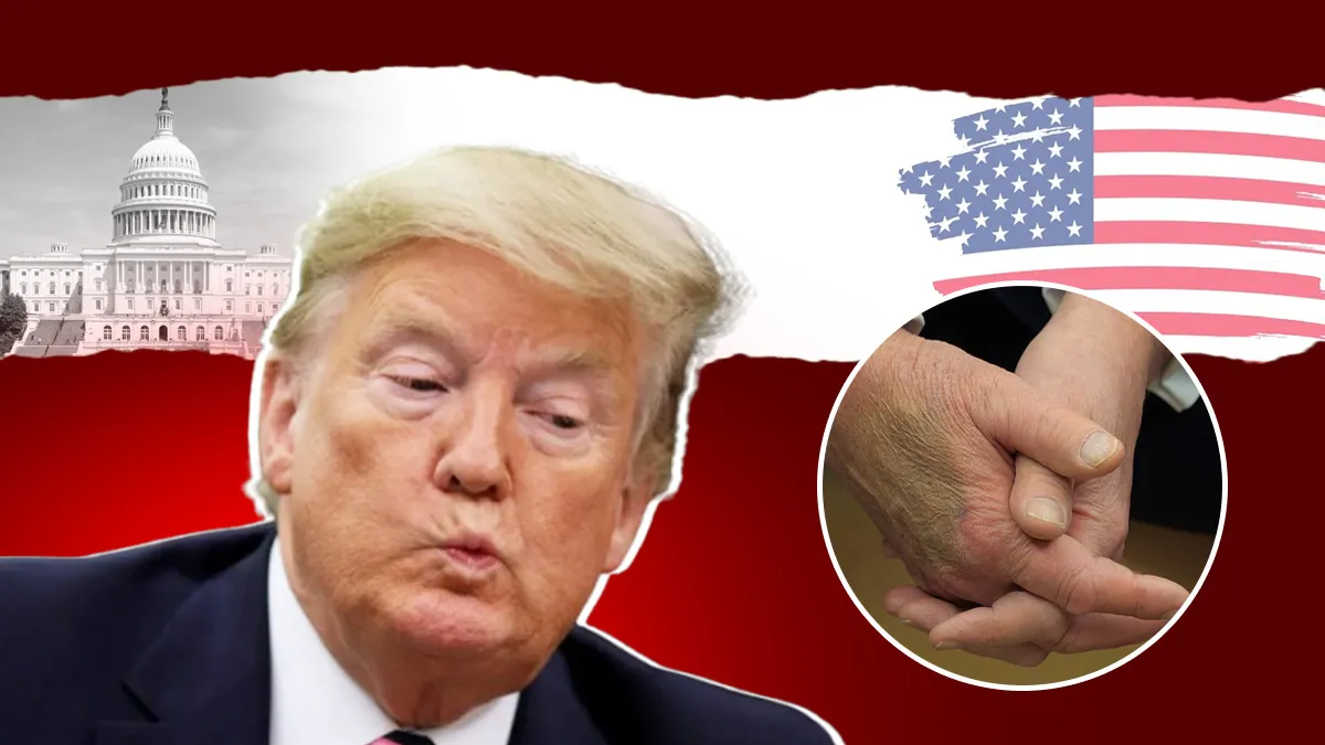 Is Donald Trump Facing Stroke Symptoms? His ‘Droopy Face’ at 9/11 Event Fuels Fresh Stroke Speculations