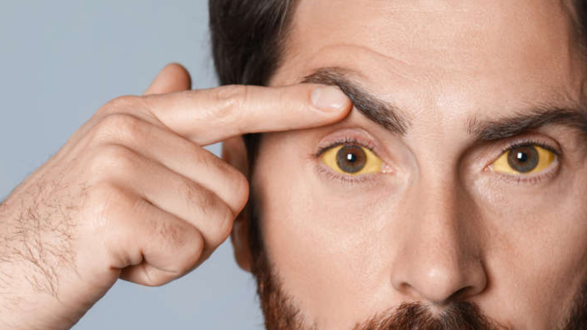 signs of cholestrol 3 - 2025-09-15T123101.119