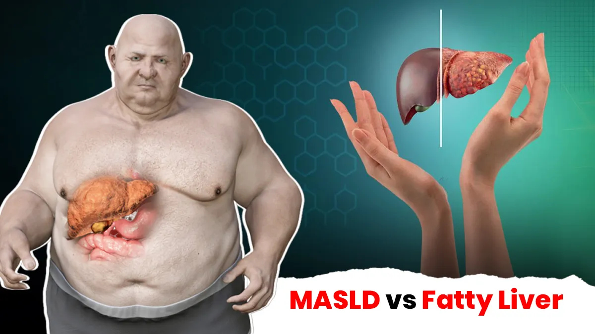 MASLD vs Fatty Liver: What Young Adults Need to Know About This Metabolic Condition