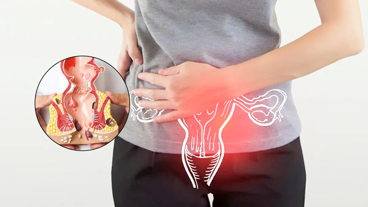 Cervical Cancer Survivors Face Nearly Double the Risk of Anal Cancer, New Study Warns
