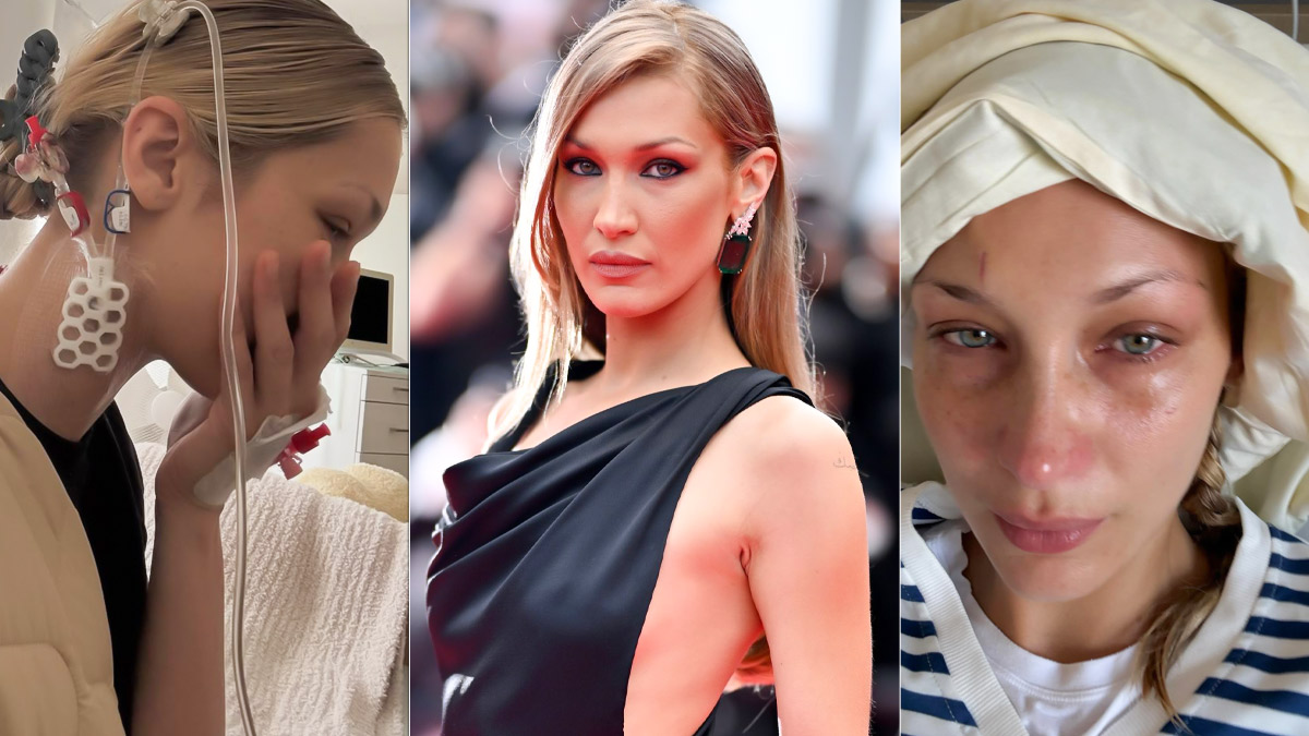 Bella Hadid Updates on Her Decade-Long Battle with Lyme Disease: How Does It Affect the Body?